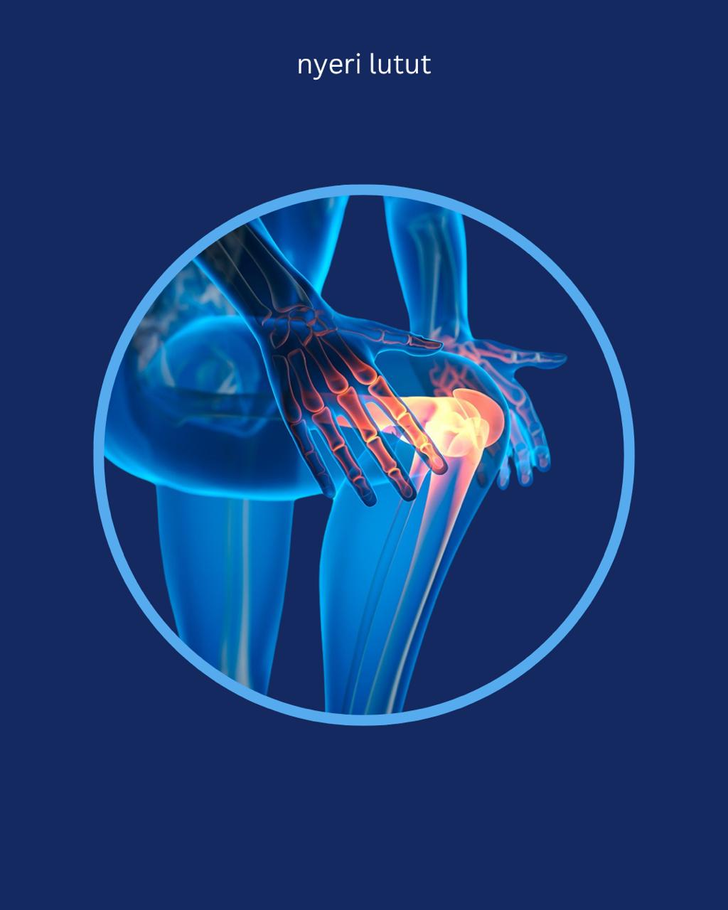 Nyeri Lutut