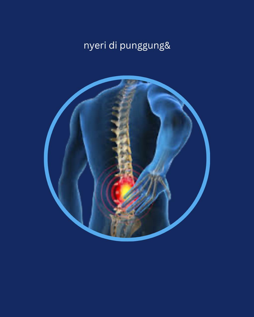 Nyeri Punggung